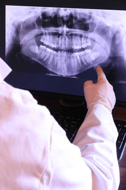 Best Emergency Root Canal Treatment in Norlina, NC