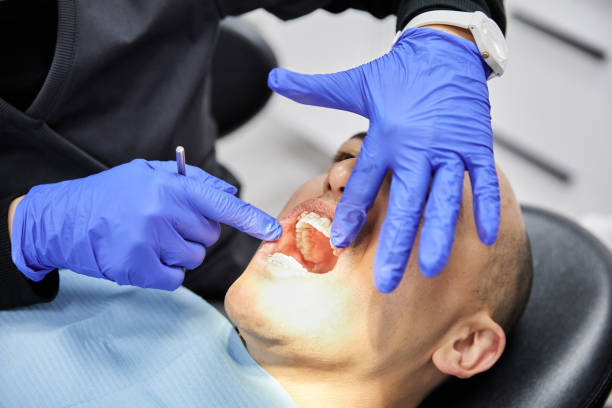 Best Emergency Tooth Extraction in Norlina, NC